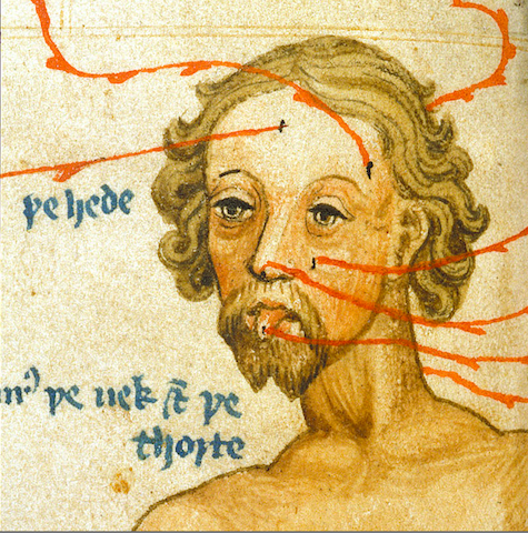 manuscript illustration of melancholy-looking man's head with veins labeled