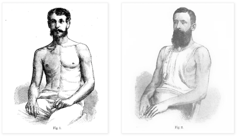 two images of muscled men with facial hair labeled "Fig. 1" and "Fig. 2"
